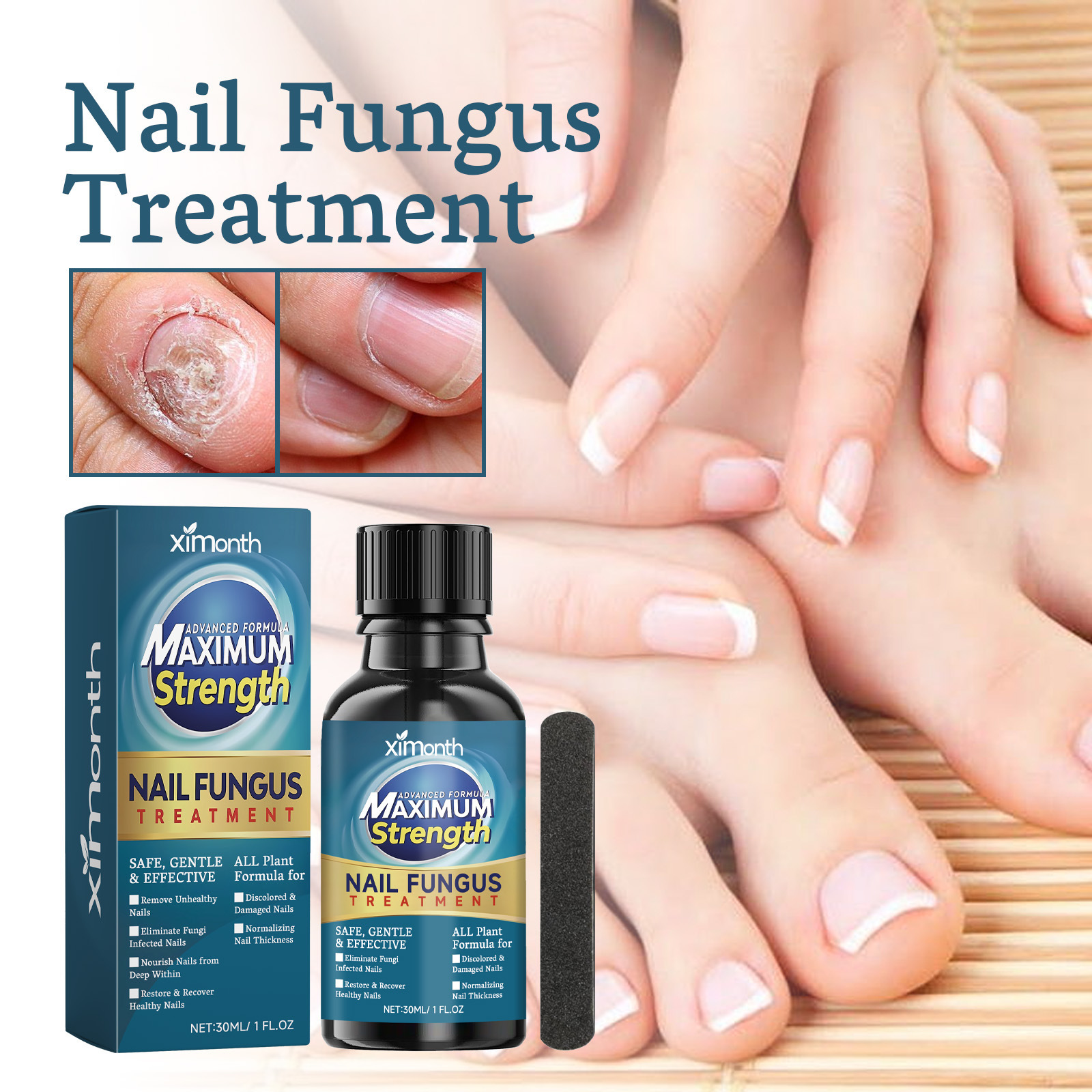 Ximonth Nail Care Solution for Ingrown Nails, Thickened Nails, Brightening Nails, Gray Nails, Soft Nails, Hand and Foot Nail Care Solution