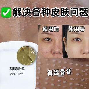 Sponge Microneedle Cream, Anti-Acne Cream, Repairing Acne Marks and Pits, Beauty Salon Special Cream, Soothing Acne Marks, Shrinking Pores Cream