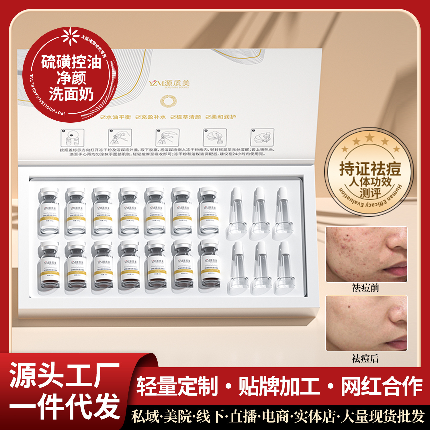 Beauty salon acne treatment freeze-dried powder set - gentle on acne, pimples, blackheads, and fades acne scars and pits.