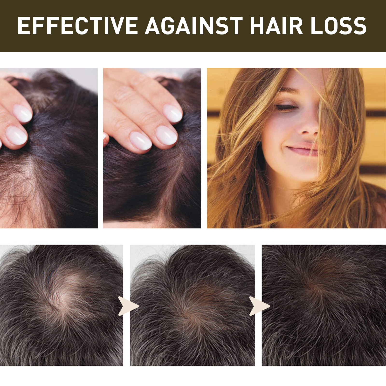 EELHOE thick hair essence repairs dull and tough hair roots scalp massage care thick hair essential oil_voghion.com