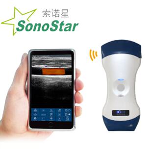 Sonostar�S��ֱ�N ����һ�o��B��̽�^���Q���ڿ��N�ƶ���ԃ�Ά��r