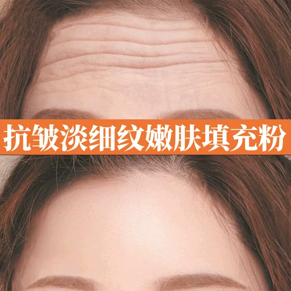 Collagen Filling Powder Cream to Remove Nasolabial Folds and Fine Lines, Plump Facial Depressions, and Tighten the Skin, Vc Filling Powder Cream Wholesale