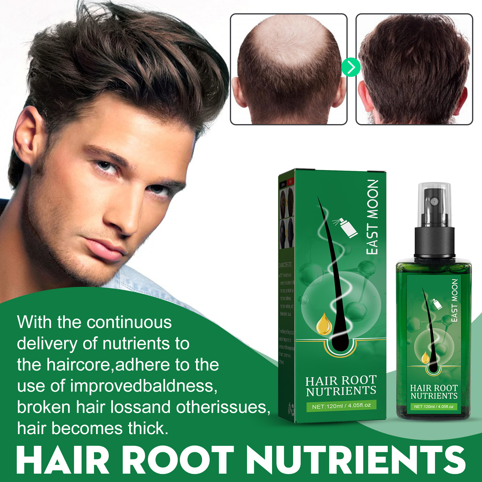 East Moon Men's Hair Growth Essenz_voghion.com