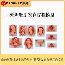 Ӌ������ ������̥�l��ģ�� ̥���γɰl���^��ģ�� ��̥�c�ӌm