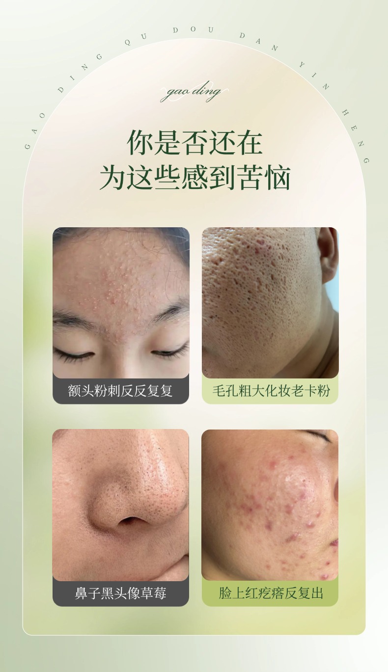 Herbal Acne Care Balm 25g External Skin Care Ointment for Face key features