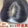 头顶无痕自然真人发