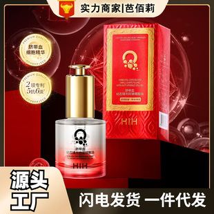 Ě��Ѫ�בB��俹�������������aˮ�������y�����aˮ��ճā