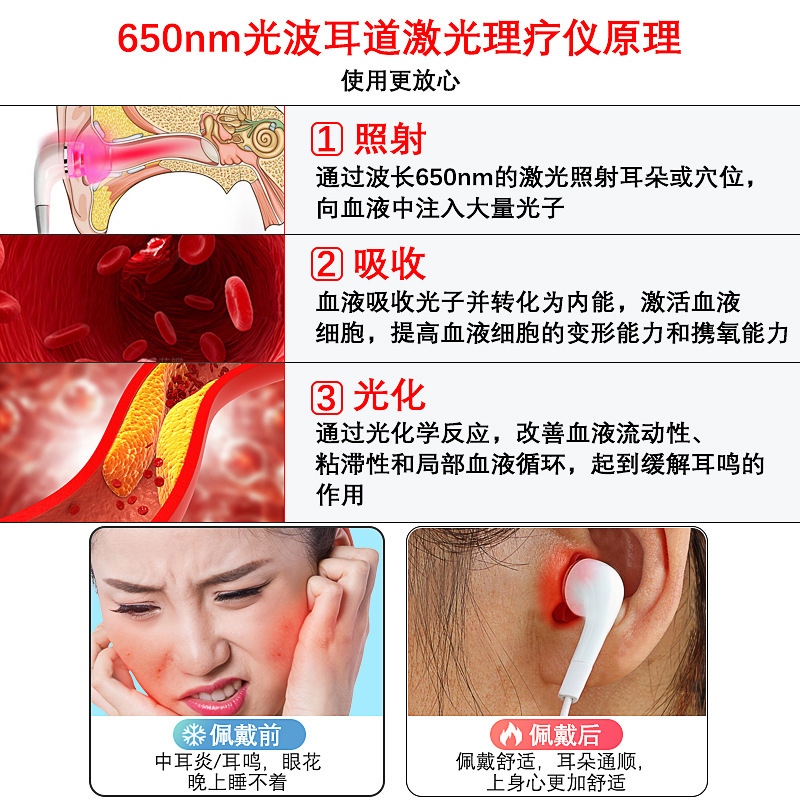 携帯病院同一タイプ650nmレーザー耳器耳光子器耳かゆみ耳栓耳炎を緩和する理学療法器|undefined