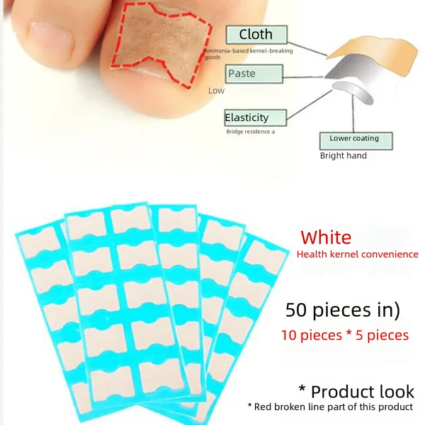 Paronychia Free Glue Nail Paste Inlaid Nail Correction Free Paste Patch Lala Paste Free Paste Corrector