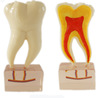 Teaching model removable oral repair model pathological dental model activity tooth model planting model