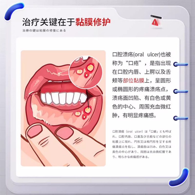 長い間、口腔の傷口を開発して修復してスプレーします。|undefined
