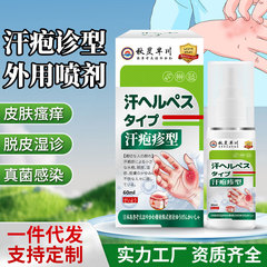 汗泡疹型保健喷剂皮肤起小疙瘩红肿瘙痒脱皮红疹汗疱型疹护理喷剂
