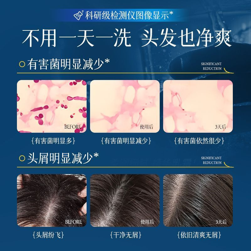 韓国漢方穀物オイルコントロールふわふわシャンプー卸売保湿保湿フケ防止かゆみ持続香りヘアケアシャンプークリーム|undefined