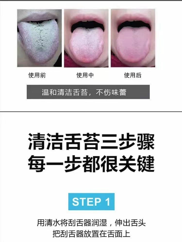 U型舌苔清洁器不锈钢刮舌器成人口腔护理刮舌头除口臭刮舌板出厂-阿里巴巴
