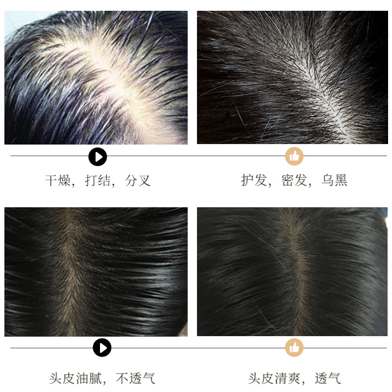 Imagen belleza ginseng champú de limpieza profunda refrescante suave hidratante champú para el cabello productos genuinos al por mayor image 5