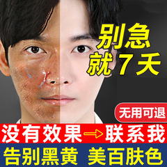 美白クリームは黒増白に行って、ぶちのクリームを取り除きます。
