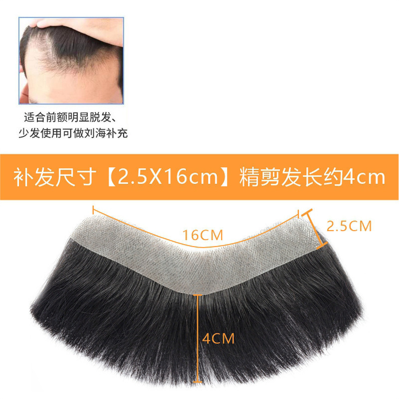 发际线假发贴假刘海假发片m形发际线贴男一片式前额补发自然真发|undefined