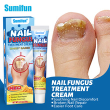 sumifun�羳��ҩ ���ۻ�ָ�׸� ��ָ�׻��������޻�������k910003