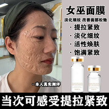 Ů����Ĥ�����o������Ժ��������y˺������TĨʽˢø��Ƥ���׺�