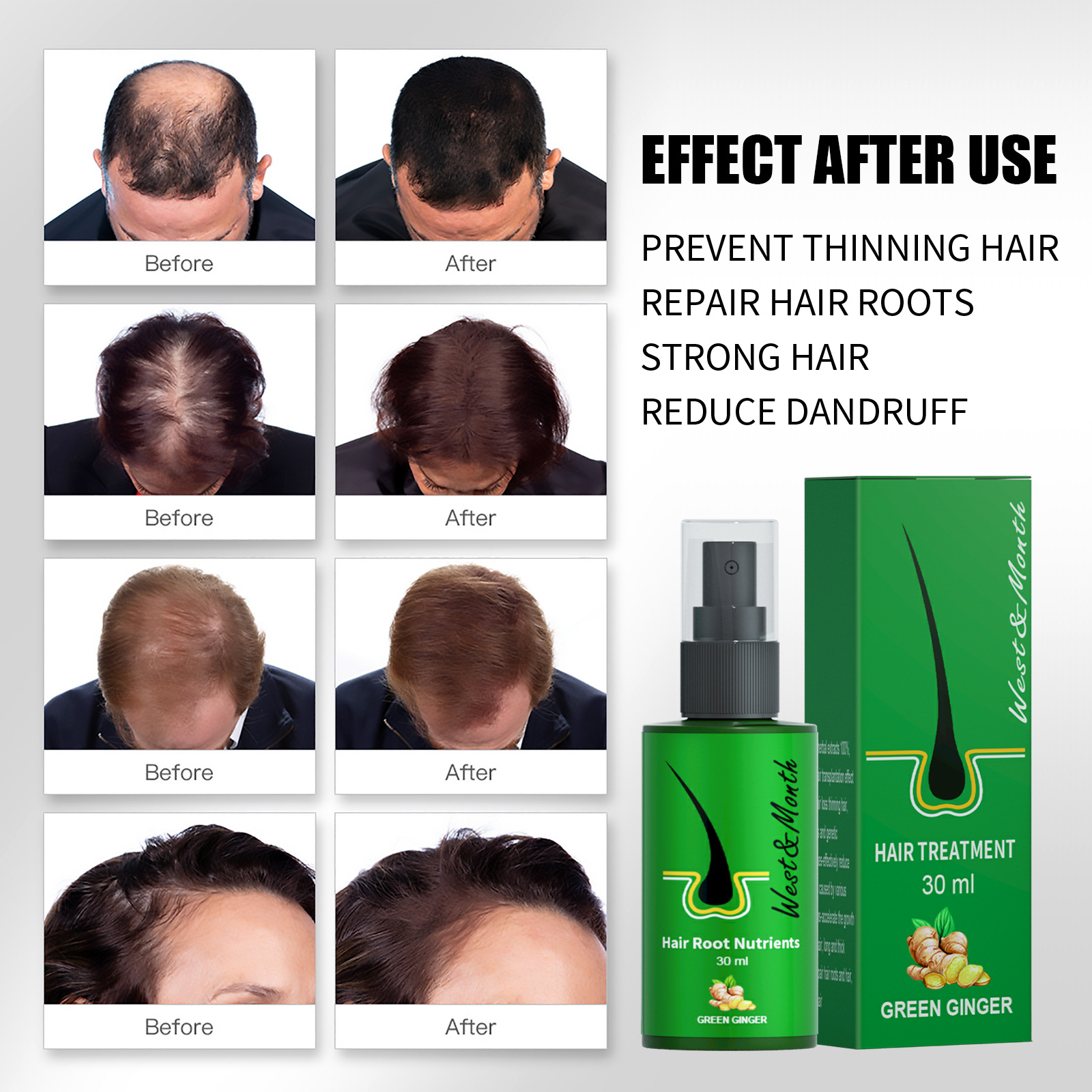 West&Month Hair Growth Lotion förhindrar ingefära från att falla av, stelnar folliklar och ger näring till svart hår_voghion.com