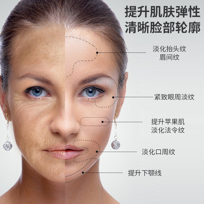 Parche facial de lifting escamoso transfronterizo, lifting facial transpirable, lifting muscular, estiramiento facial, parche antiarrugas, parche de línea de frente