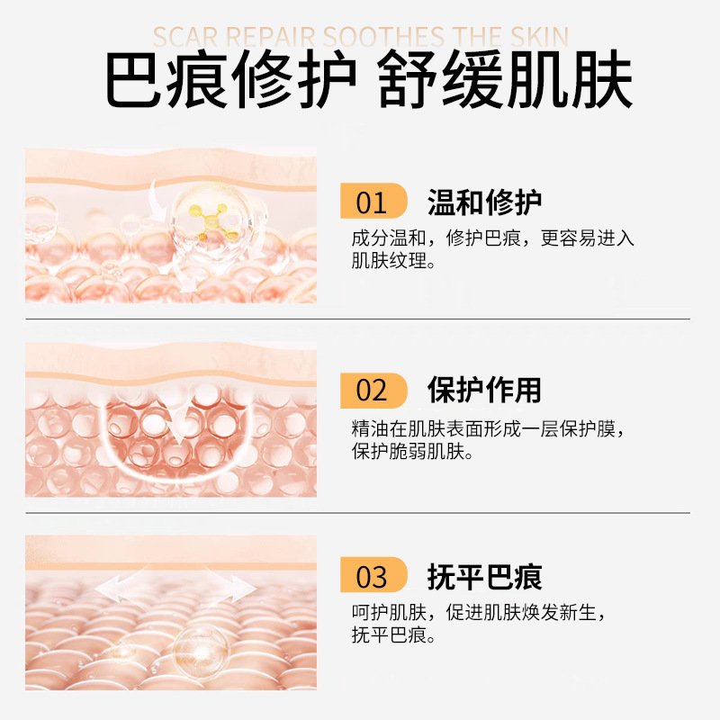 久木堂疤复平痘坑痘印晒后修护霜凹凸伤疤复方|undefined