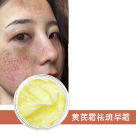 黄芪霜祛斑早霜提亮嫩肤淡化色斑雀斑黄褐斑美容院线 贴牌代加工