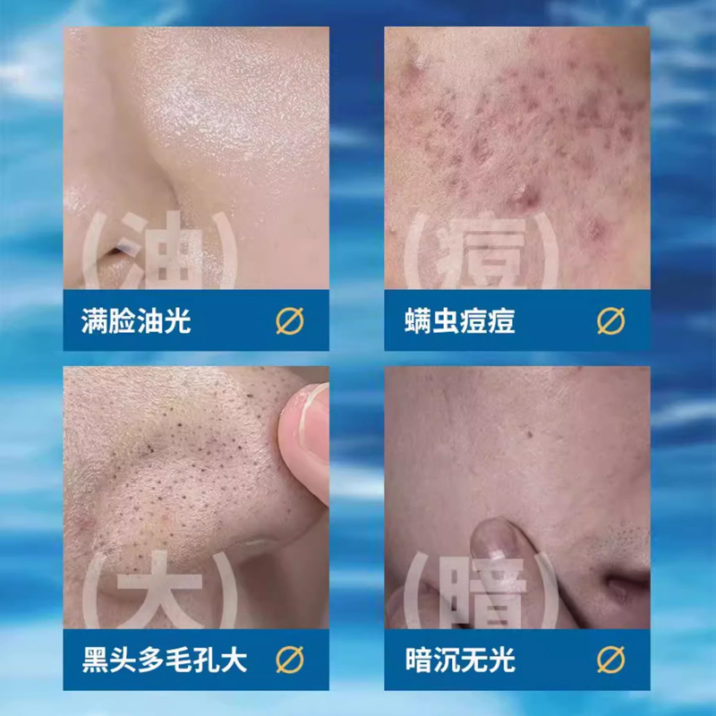 Su Xiuchen のアミノ酸リフレッシュ オイル コントロール メンズ フェイシャル クレンザー 水分補給と保湿のクレンザー|undefined
