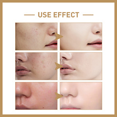 EELHOE 大米爽膚水 深層補水修護皮膚屏障緊緻柔潤面部肌膚爽膚水