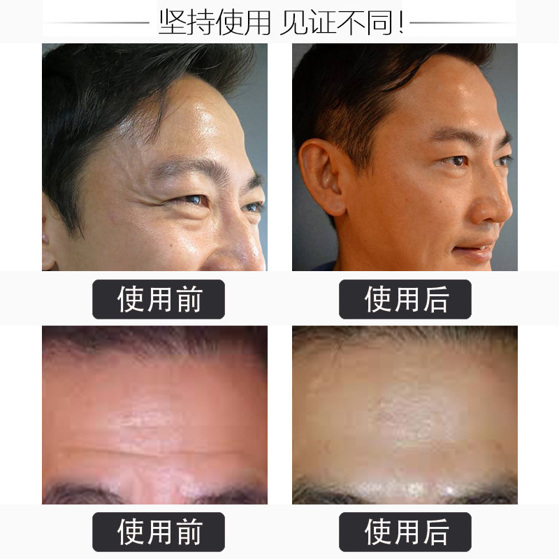 六勝ペプチド抗シワコンパクトクリーム淡々とした小紋が引き締まって薄いシワを改善し、シワ取りクリームを改善します。|undefined