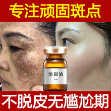 无创溶斑液不脱皮淡斑精华去雀斑黄褐斑黑色素美容院祛斑液排色液