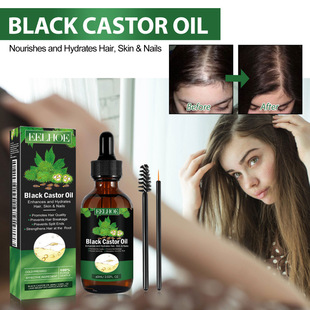 EELHOE Castor Oil Hair Solution Hair Anti-drop Tough and Solid Hair Dense Hair Scalp Massage Nutritional Care Solution