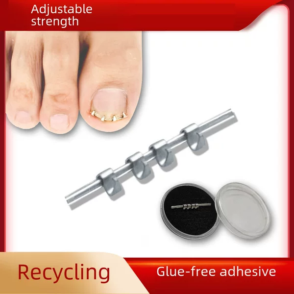 Orthopedic nail paste physical stretch roll armour lala orthopedic nail paste reverse pull inlay armour nail hook orthopedic nail buckle nail groove correction