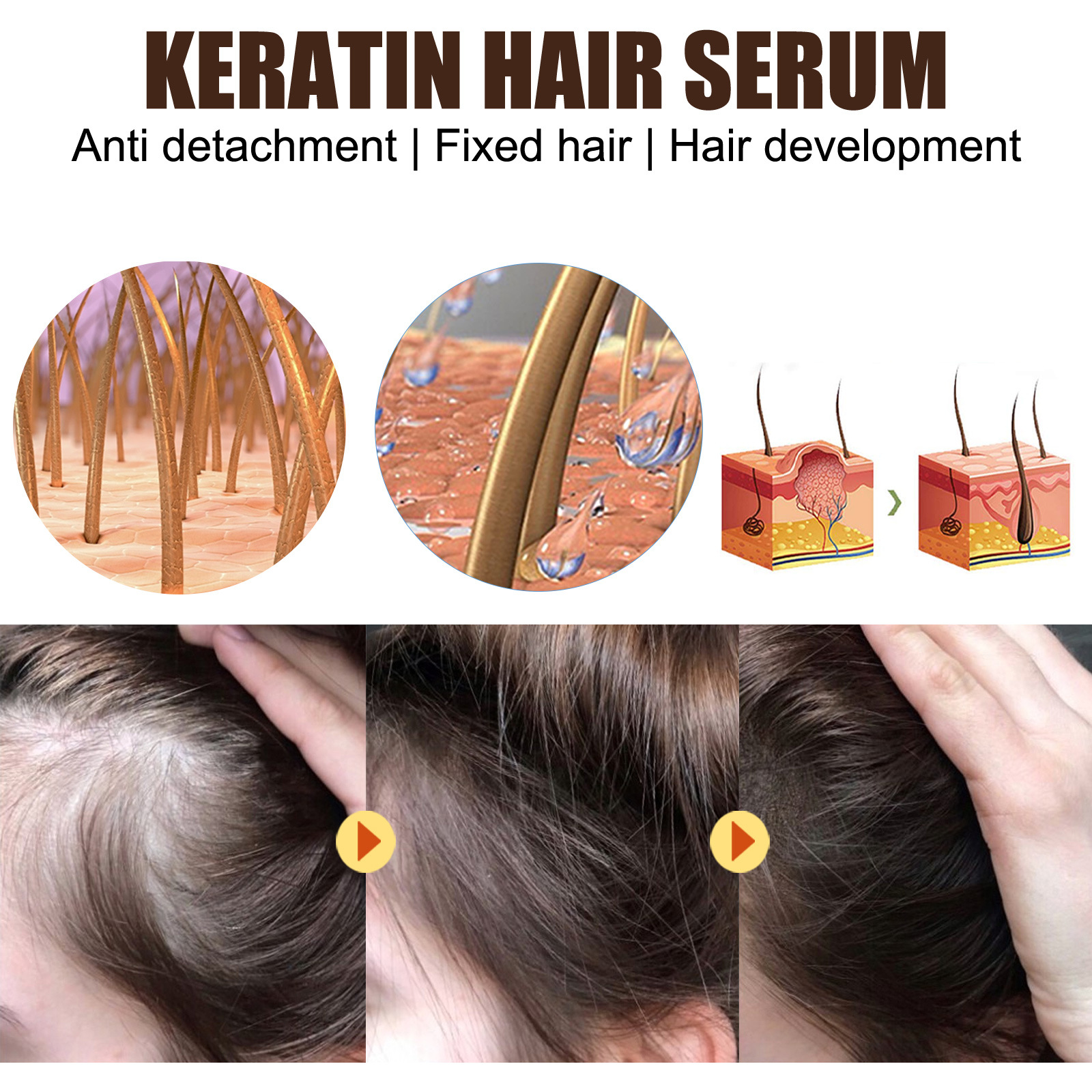 EELHOE Hair Thickness Essence Spendet dem Haar Feuchtigkeit, repariert die Haarwurzeln, verdickt den Haaransatz, kräftigt und stärkt das Haar, Haarpflege-Essenz_voghion.com