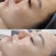 Beauty Salon Creates Bare-Faced Bulb Skin Tone and Rejuvenating Facial Kit Melanin Metabolism Liquid into Beauty Essence