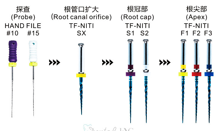 牙科机用镍钛根管锉S1S2F1F2F3大锥度锉热激活锉机扩针扩大针厂家-阿里巴巴