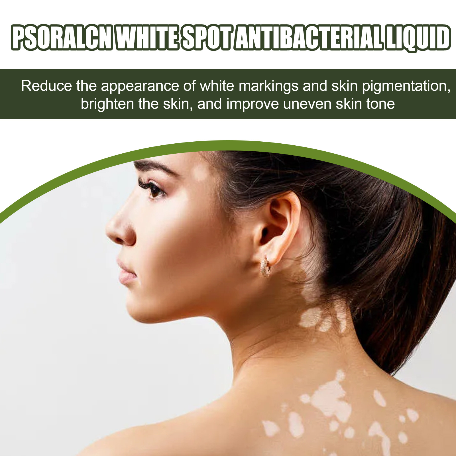 EELHOE Entferner Haut Leukoplakie Schweißfleckennetz Außenpflege Psoralen Essenz_voghion.com