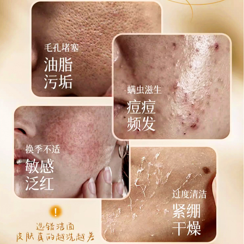 Filipinos cherry berry limpia crema de exfoliación antiarrugas hidratante, exfoliación suave, piel limpia y suave.