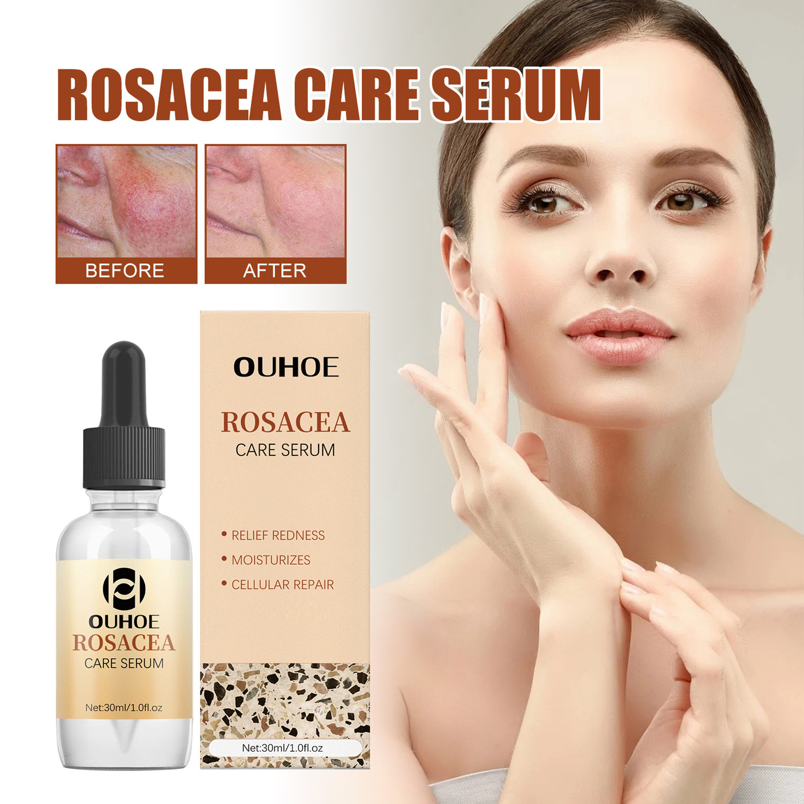 OUHOE Repair essence Repairs Skin Barrier, Lightens Facial Erythema Moisturizing Essential Oil_voghion.com