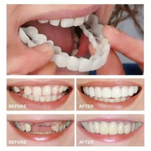 2025 New Cross-Border 4-Pack White Denture Veneers with Flexible Cross-Border Functions