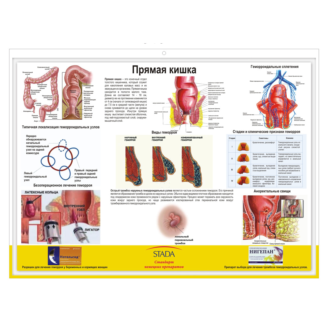 厂家制作耳鼻喉挂图 pvc立体凹凸挂图 医用挂图 肠道消化系统挂图