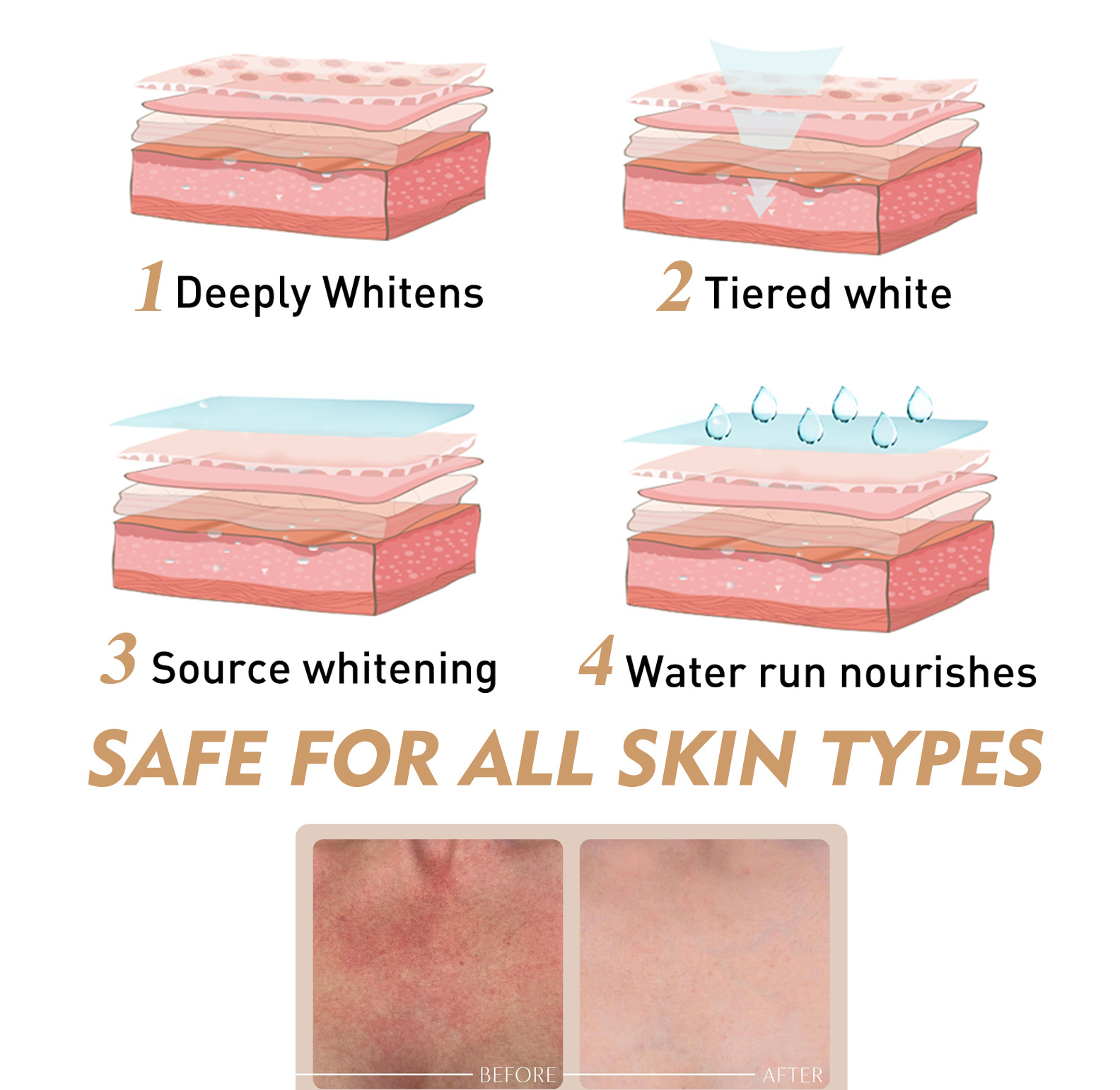 Haut, Körper, feuchtigkeitsspendend und feuchtigkeitsspendend, Gelenkaufhellung, Entfernung von schwarzen Flecken, aufhellende Essenz zur Hautentfernung, 2024, 2024 neu_voghion.com