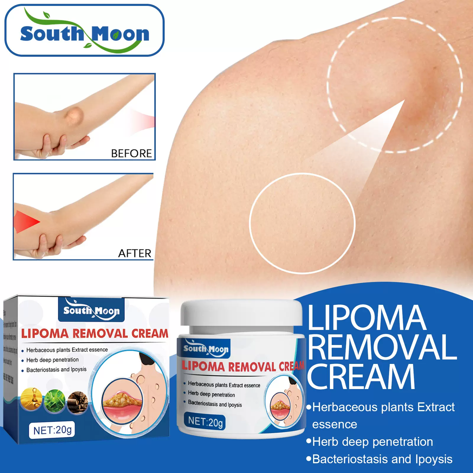 South Moon脂肪结膏修护疏通脂肪结块硬块结节皮下肿块身体护理膏
