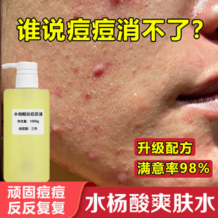 ˮ����ˬ�wˮ�ߝ�ȶ������o������ӡ�ഺ���տsë���ɶ���2%ԭҺ