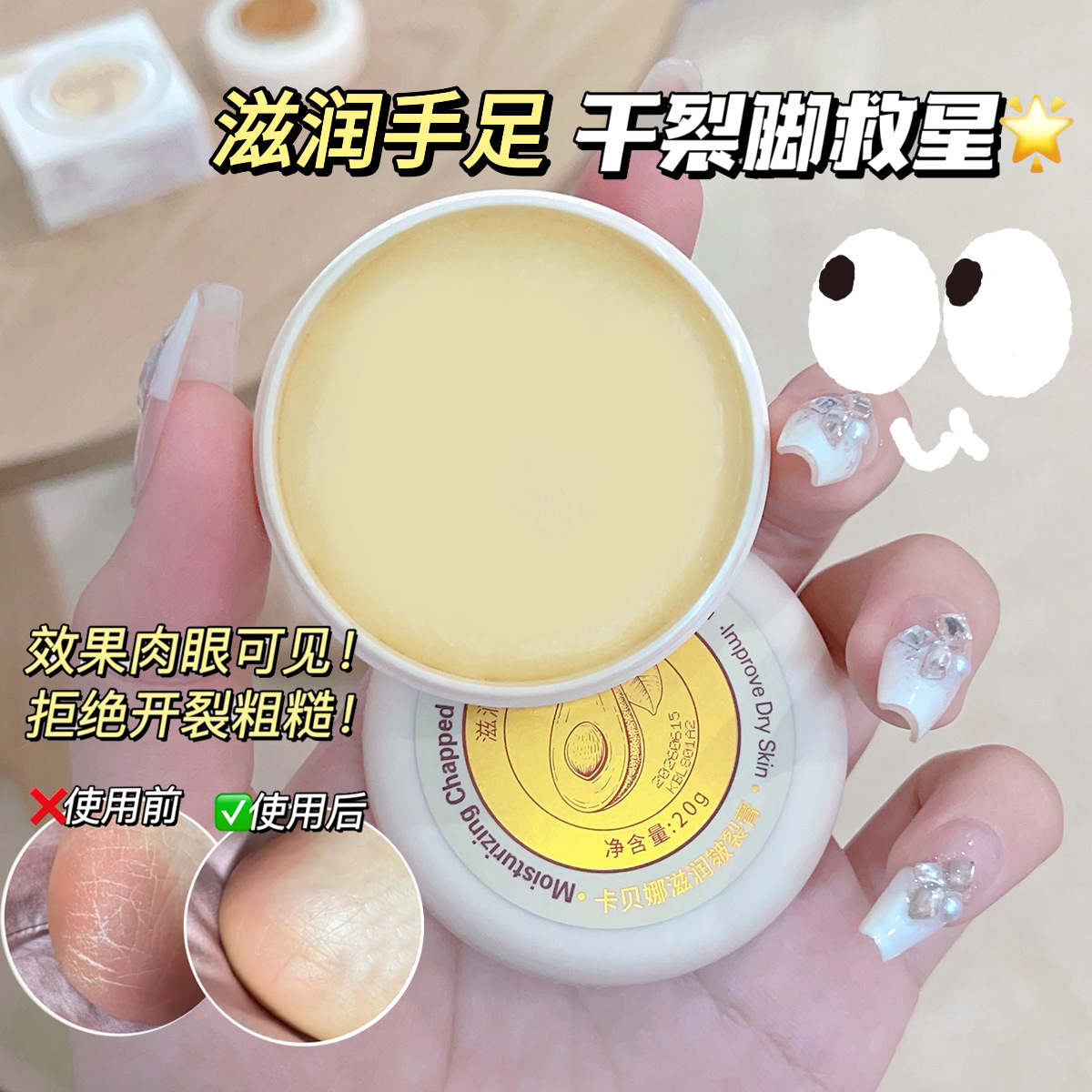 Cabena Moisturizing Crack Cream 20g Hand Cream Foot Cream Frost Crack Repair Cream Anti-Crack Cream Crack Cream Source Factory