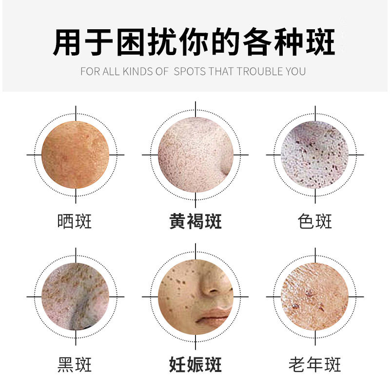 现货祛斑霜批发Freckle cream 滋润补水保湿提亮肤色美白面霜厂家|undefined
