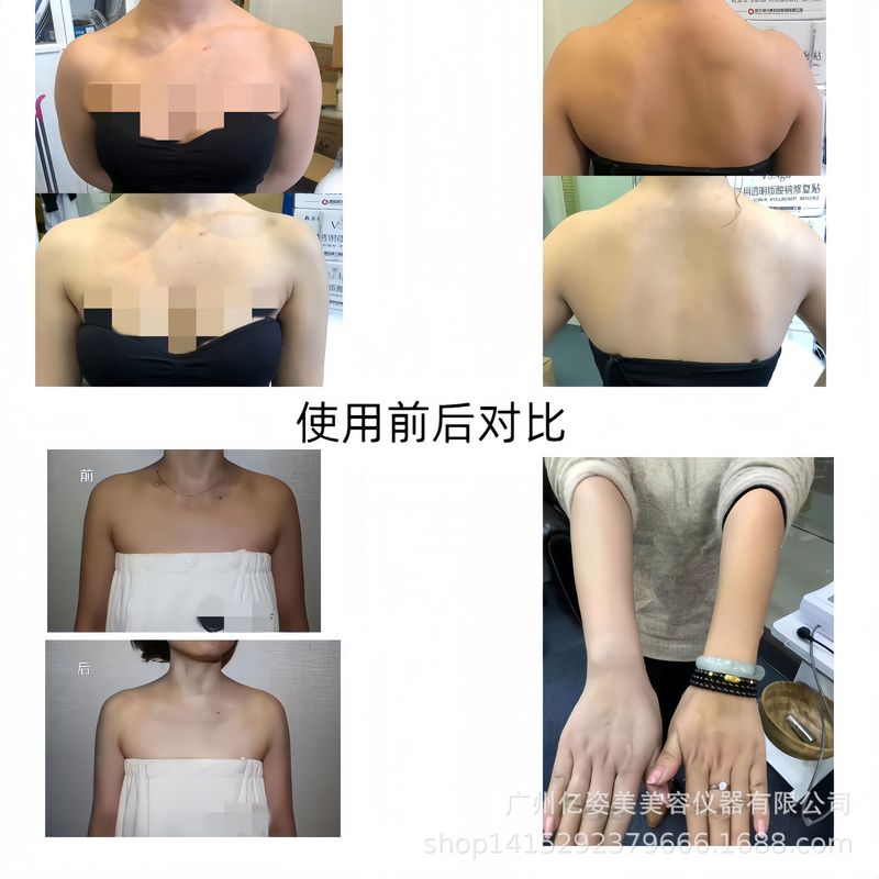 億姿の美しい赤い光のコラーゲンの柔らかい肌の美白倉庫の宇宙室の多機能の光子の柔らかい肌の抗衰えの美容の器具|undefined