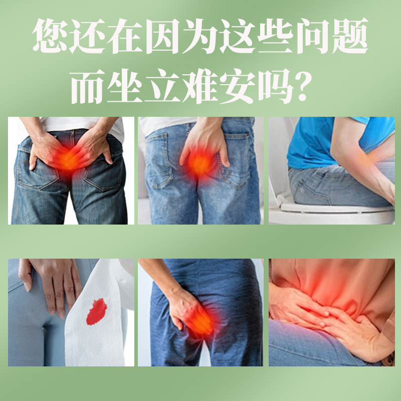 苗祖老毒痔疮膏草本乳膏老毒痔疮断痔膏古方外用男女通用草本配方|undefined