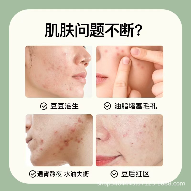 婷喜欢豆舒灵草本萃取皮肤外用抑菌乳膏凝胶【厂家直销】|undefined