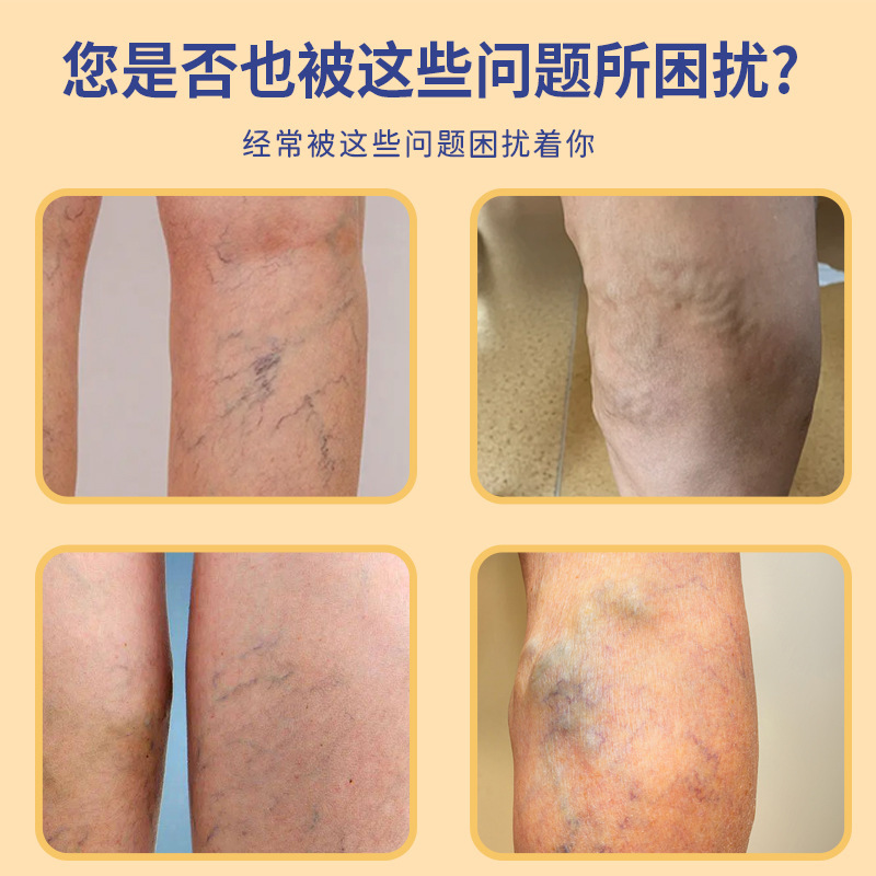 批发香港大药房草本静膏脉膏曲膏张膏肿胀蚯蚓腿厂家一件代发|undefined